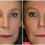 austin cosmetic treatment results