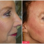 austin woman cosmetic treatment results