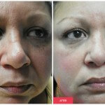austin woman results cosmetic treatment
