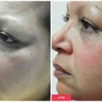 austin cosmetic surgery patient results