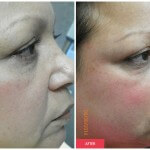 austin woman beauty treatment results