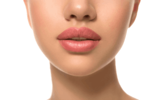 lip augmentation austin results